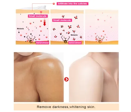 Wholesale OMY LADY Fast Effects Black Skin Fruit Body Bleaching Lotion