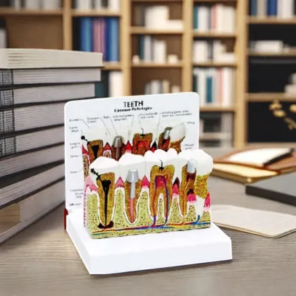 DARHMMY Medical Science Dental Pathology Models and Teaching Aids