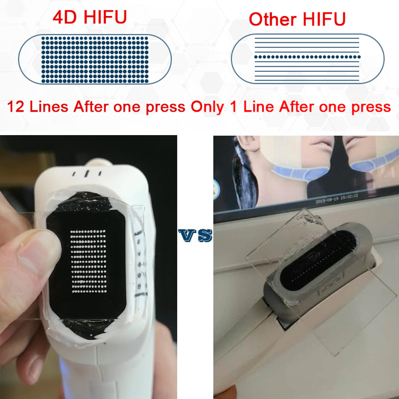 best hifu machine for home use