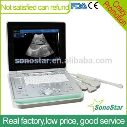 Sonostar Ultrasonic Diagnostic Devices Digital Portable Ultrasound Machine Price SS-9