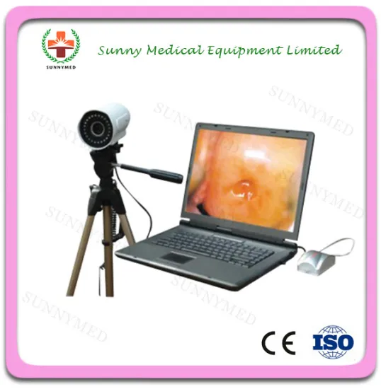 SY-F003 obstetrics & gynecology equipments portable Electronic power digital video Colposcope