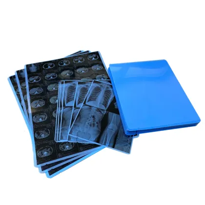 Inkjet Printing Medical Dry Laser X-ray Imaging Film