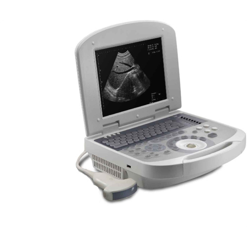 b/w laptop ultrasound machine for pregnancy