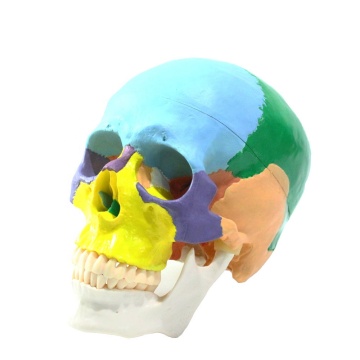 Life-Size Colored Human Skull Model with Contrasting Colors for Bony Plate Identification