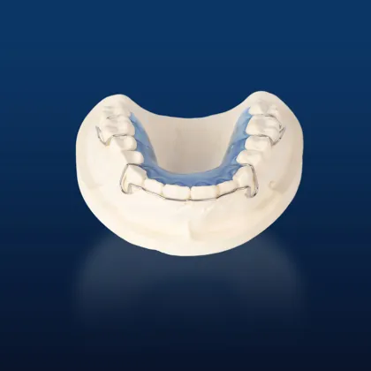 Dental Teeth Ortho Appliance for Jaw Alignment