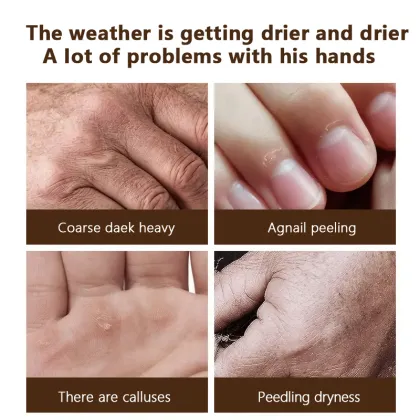 Natural Non-Greasy Foot Cream: Moisturizing, Exfoliating, and Brightening Foot Mask