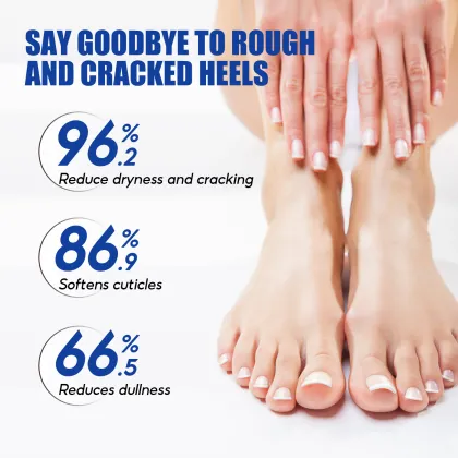 Private Label Urea 60% Foot Cream - Repair Cracked Heels 200ml Massage Cream