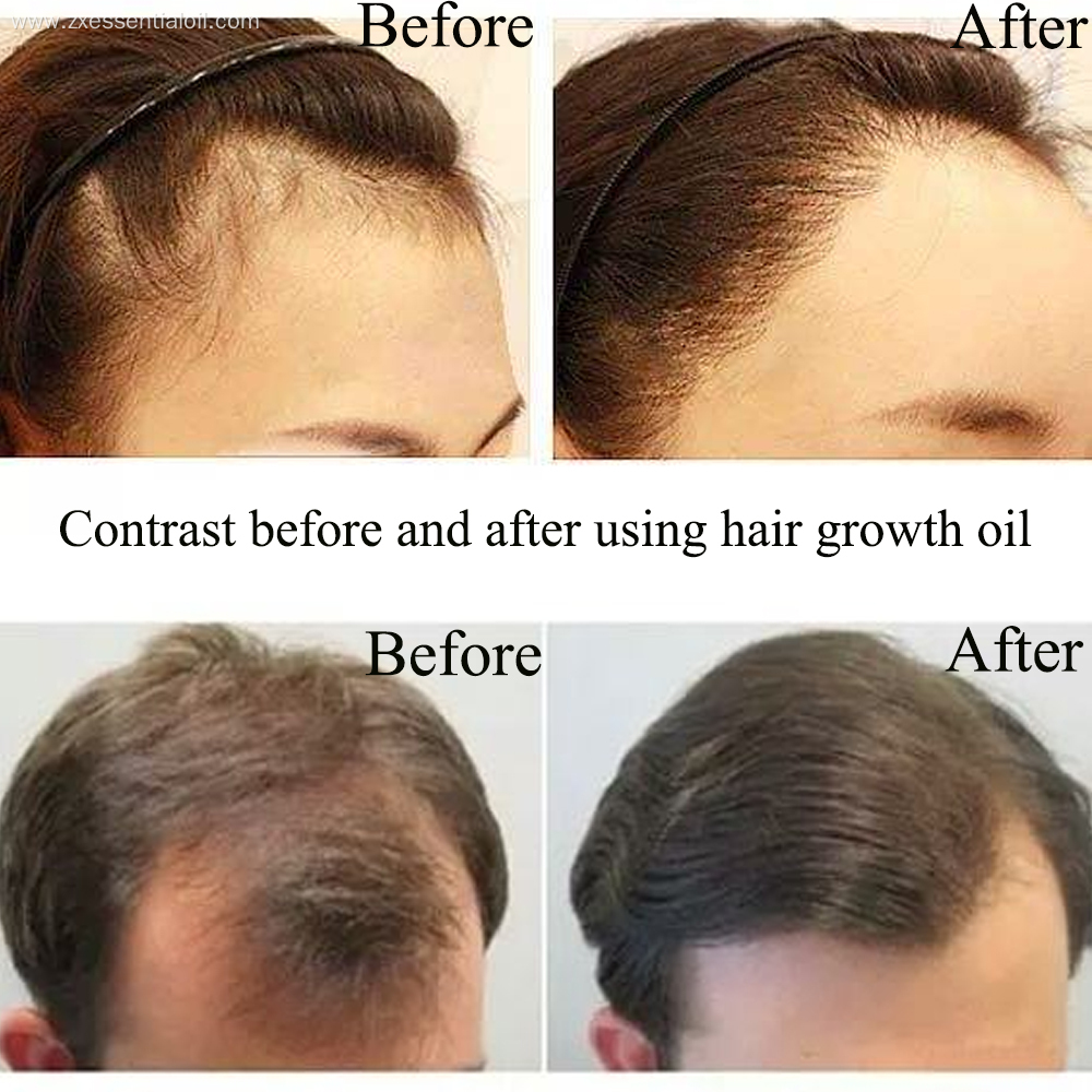 Pure plants extract hair growth oil 100% pure