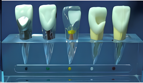 Model klinikal endodontik