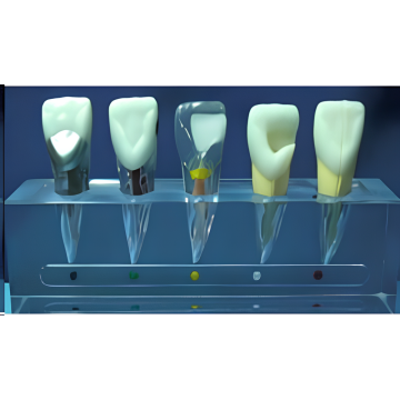 Model klinikal endodontik