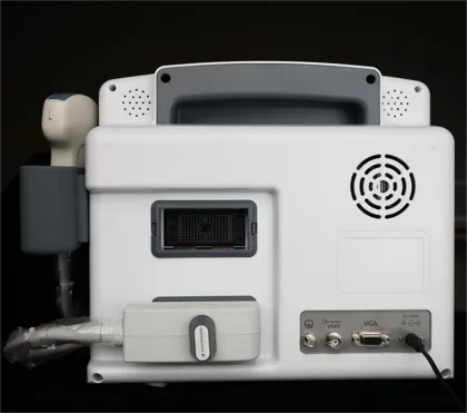 Portable Color Doppler Ultrasound Machine for Cardiac