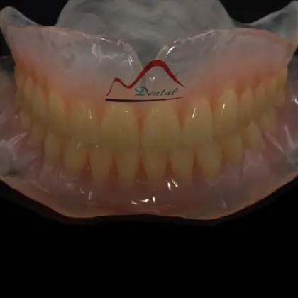 Beauty Clear Complete Denture