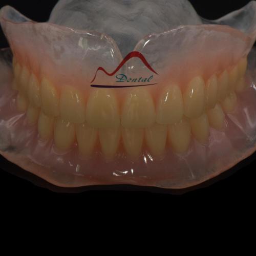 Beauty Clear Complete Denture