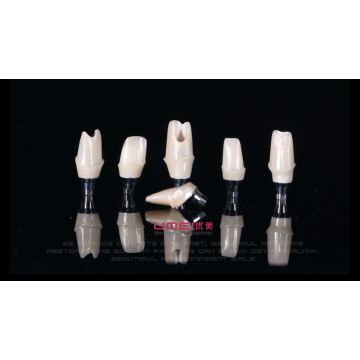 Zirkonia -benutzerdefinierte Implantat Abutment