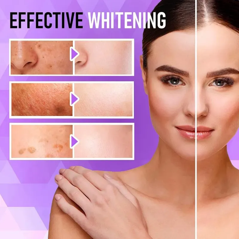 OEM Dark Spots Remover Hyperpigmentation Care