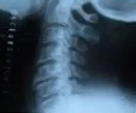 cr x-ray system x ray scanner x-ray machine prices agfa digital film x ray machine film