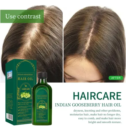 Gooseberry Hair Care Massage Essential Oil for Smooth Hair
