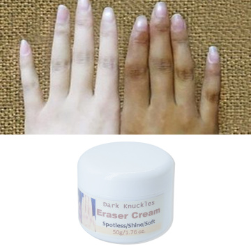 Handknöchel -Lichtcreme -Whitening -Creme für Hand