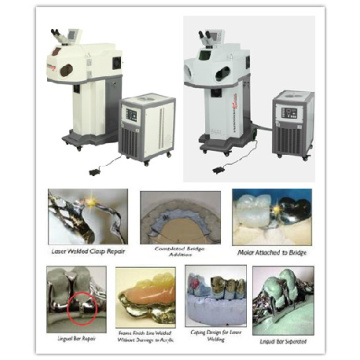 Dental Laser Welding for Dental Laboratory Welding Repairs