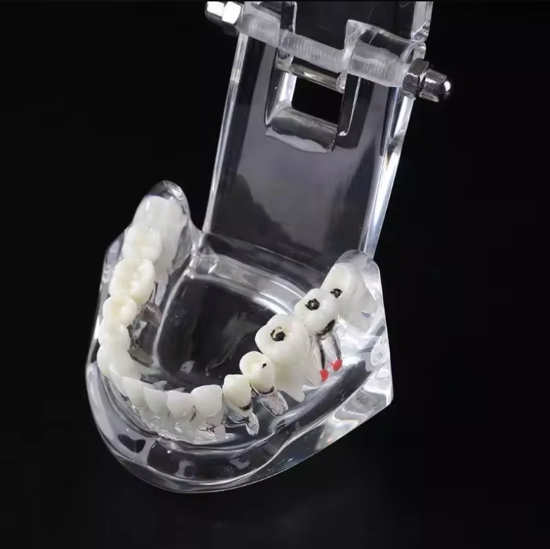 Dental Removable Demonstration for Teaching Teeth Model