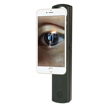 6X Portable Digital Veterinary & Human Slit Lamp with APP and Mobile Adaptor - S150D China Ophthalmic