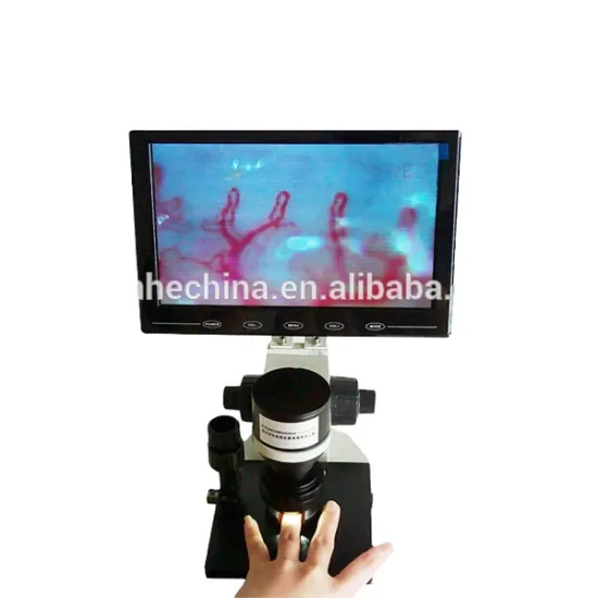 Portable Nailfold Capillaroscopy Microcirculation Test Machine