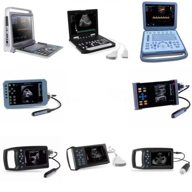 Portable 4D Ultrasound Machine for Veterinary Use