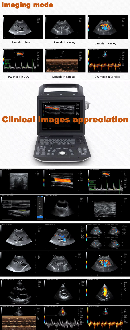 Full Digital Color Doppler Ultrasonic Diagnostic Instruments