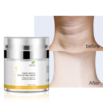 Pencahayaan mengetatkan kedutan Remover krim leher kulit gelap