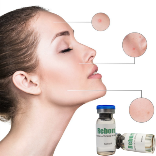 Rejuvenescimento da pele PLLA Hydrogel Filler