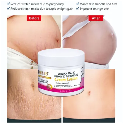 Anti-Wrinkle & Scar Removal Cream: Repair Skin, Reduce Stretch Marks