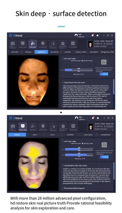 2023 Newest Digital Skin Scanner 3D Analyzer - Portable Magic Mirror Facial Skin Analyzer Machine