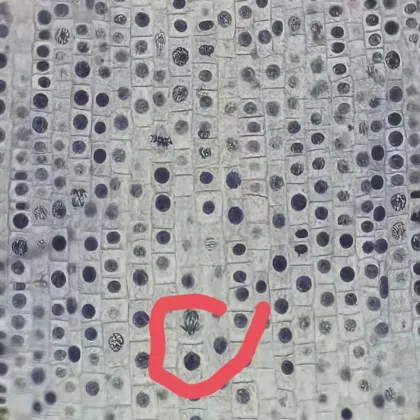 Mitosis Slides Set - Onion Root Tip 5pcs - FRT1001 - Plant Genetics and Biology