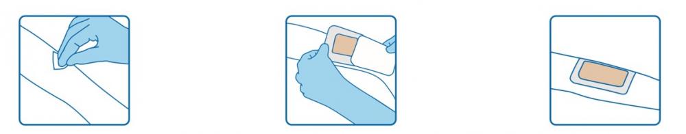 Zhende Hydrocolloid Dressing