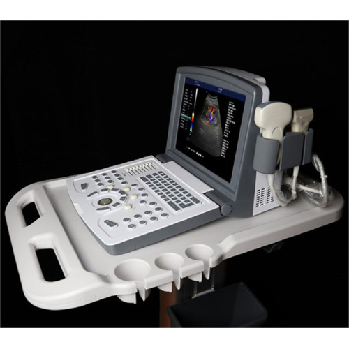 Portable Color Doppler Ultrasound Machine for Gynecology