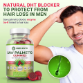 Жители мужчин видели лакомские угощения Palmetto