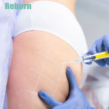 Medical Cosmetic Filler for Skin