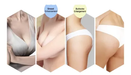 Hyaluronic acid breast injection breast enlargement