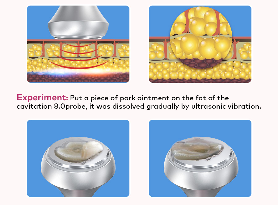 cavitation machine for slimming