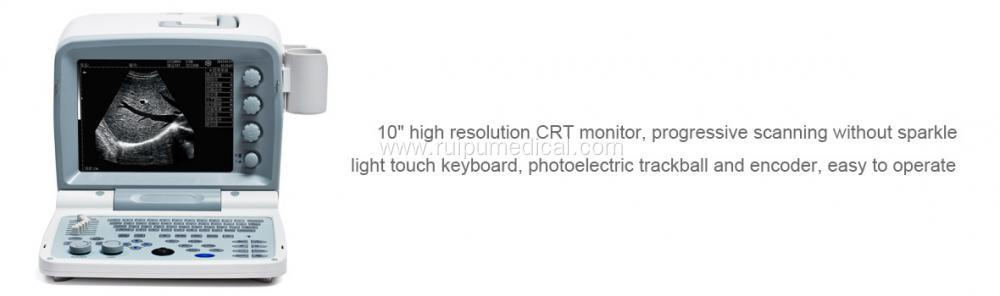 Full Digital B Mode Ultrasonic Diagnostic Instruments