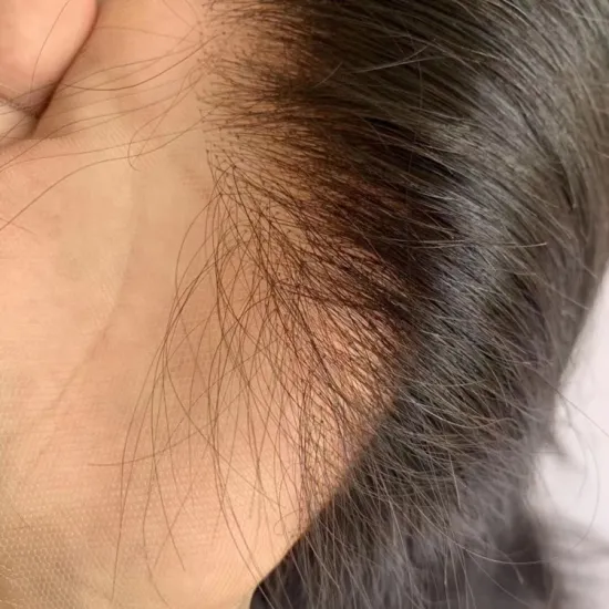 100% Virgin Human Hair Wigs: Natural Color, 4x4/5x5 Closures, 13x4/13x6 Frontals - Preplucked & Undetectable HD Lace Wigs