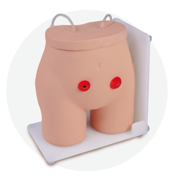 Modelo de enfermería de ostomía de fístula