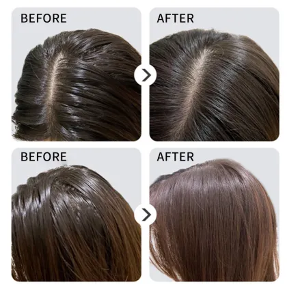 Anti-Dandruff Moisturizing Shampoo And Conditioner Set