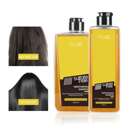 Anti-Dandruff Moisturizing Shampoo And Conditioner Set