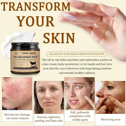 Private Label Beauty Skin Care Products Beef Tallow Cream Balm with Honey and Olive Oil for Moisturizing Skin Body Care