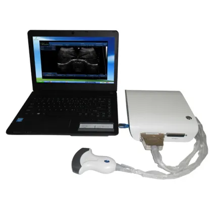 UBox-10 B/W Ultrasound Box