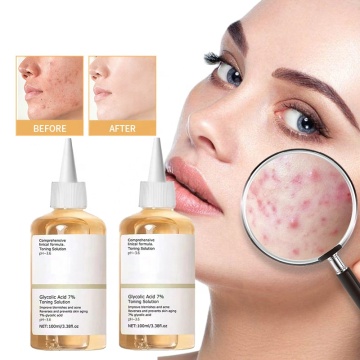 Wholesale Glycolic Acid 7% Toner for Blemishes and Acne
