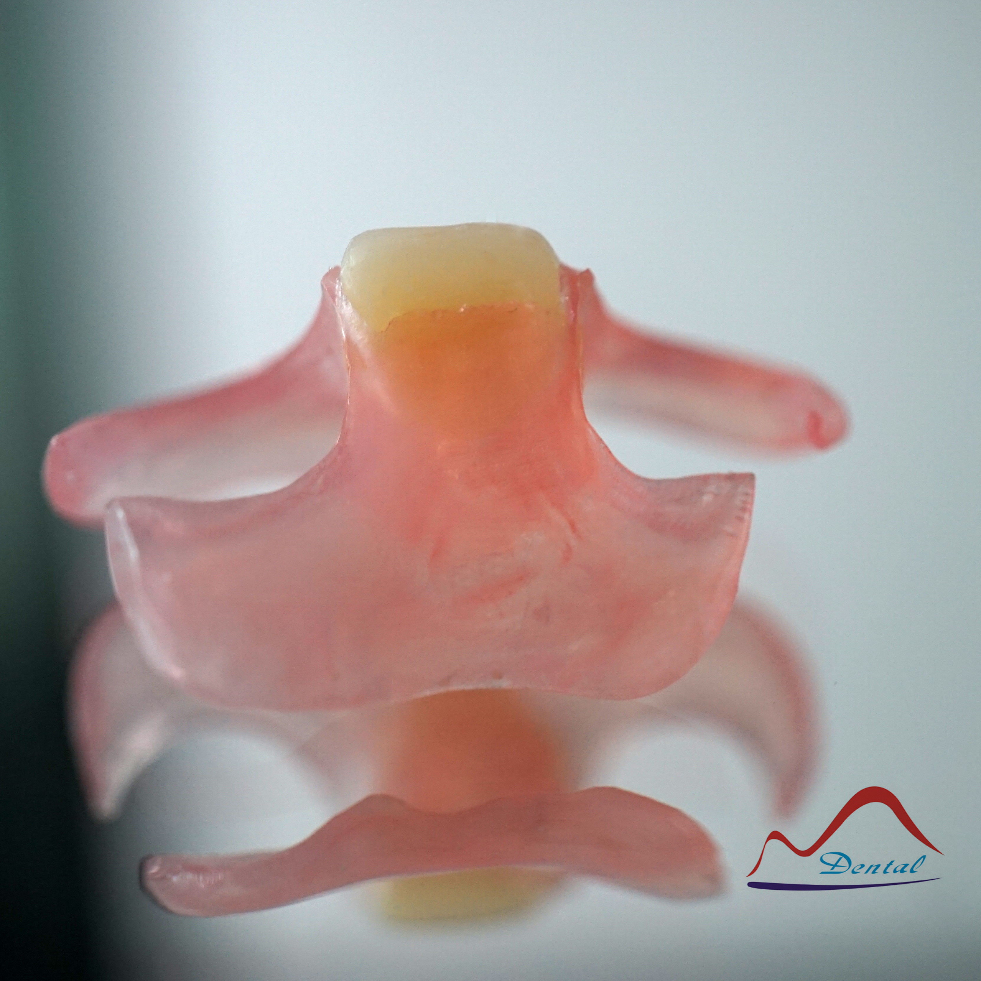 Valplast Denture On 3D Printing Model (5)