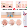 Vacuum Blackhead Remover Suction Face Pimple Acne Comedone Extractor Deep Cleansing Beauty Skin Care Tool aspirateur point noir