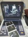 Bärbar 4D Cardiac Color Doppler Ultraljudsskanner